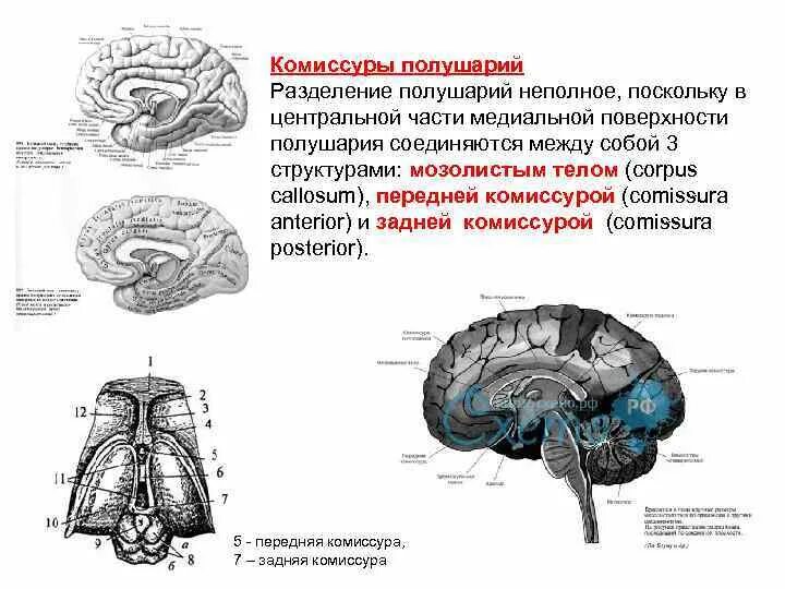 Полушария соединяет между собой. Межполушарные комиссуры. Межполушарные взаимодействия комиссуры. Мозолистое тело располагается между ____________ головного мозга. Мозолистое тело анатомия мрт.