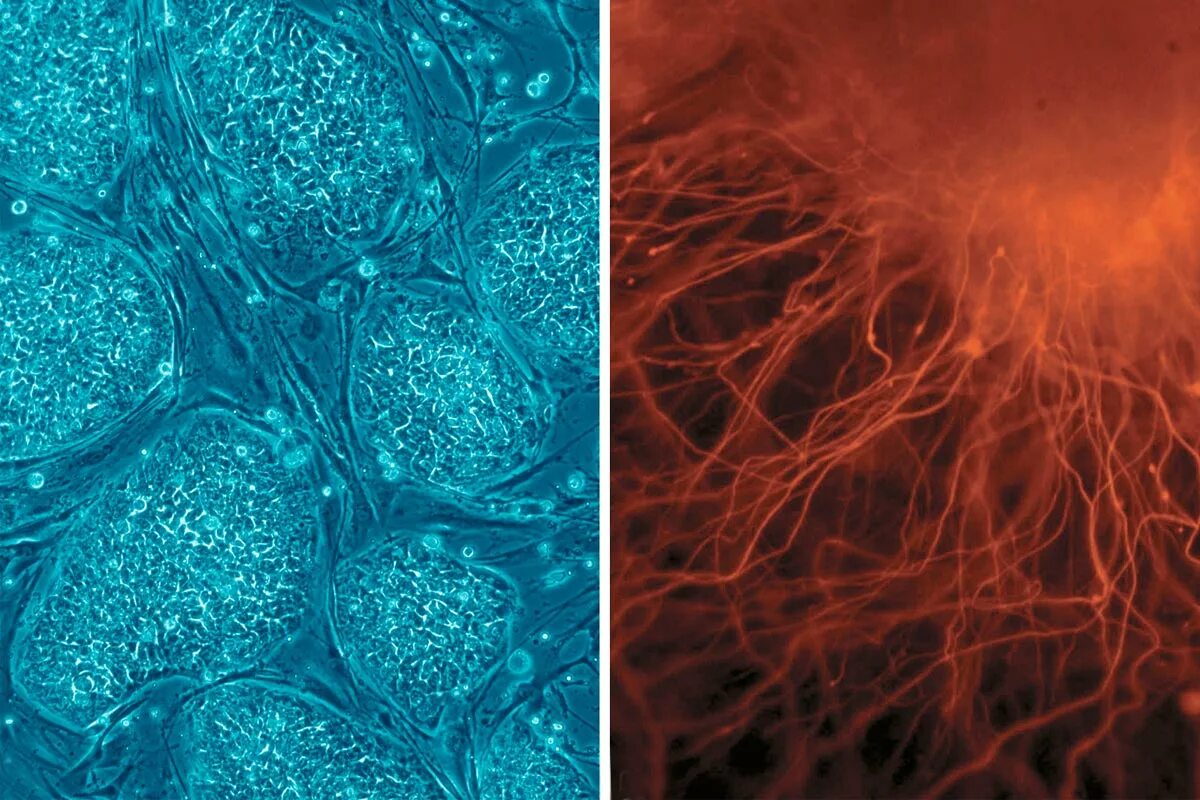 Стволовые клетки микрофотография. Эмбриональные стволовые клетки человека. Фетальные стволовые клетки под микроскопом. Эмбриональные стволовые клетки под микроскопом.