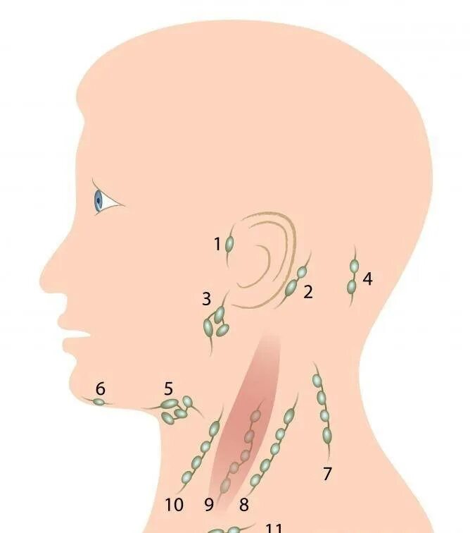 Воспалённые околушныее лимфоузлы. Шейные лимфоузлы расположение и ушные. Лимфоузлы шеи схема воспаление. Околоушные лимфатические узлы. Лимфоузлы затылочные причины