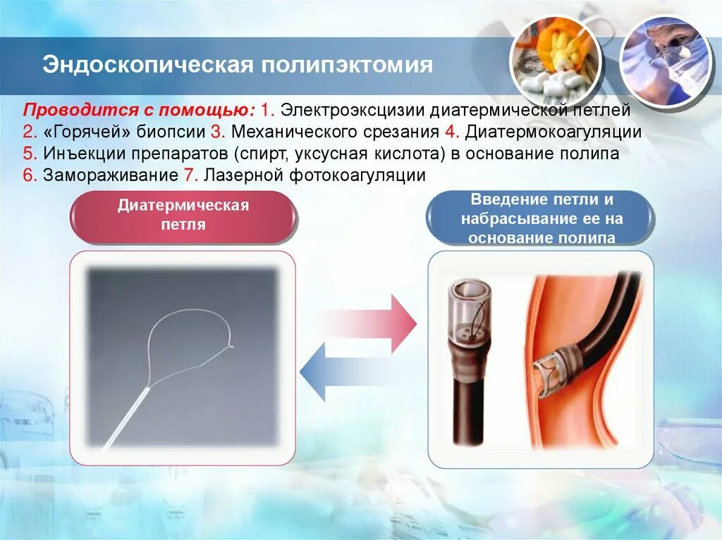 Диета полипэктомии. Эндоскопическая полип эктопия. Эндоскопическая плеврэктомия. Эндоскопической полипэктомии. Эндоректоскопическая полипэктомия.