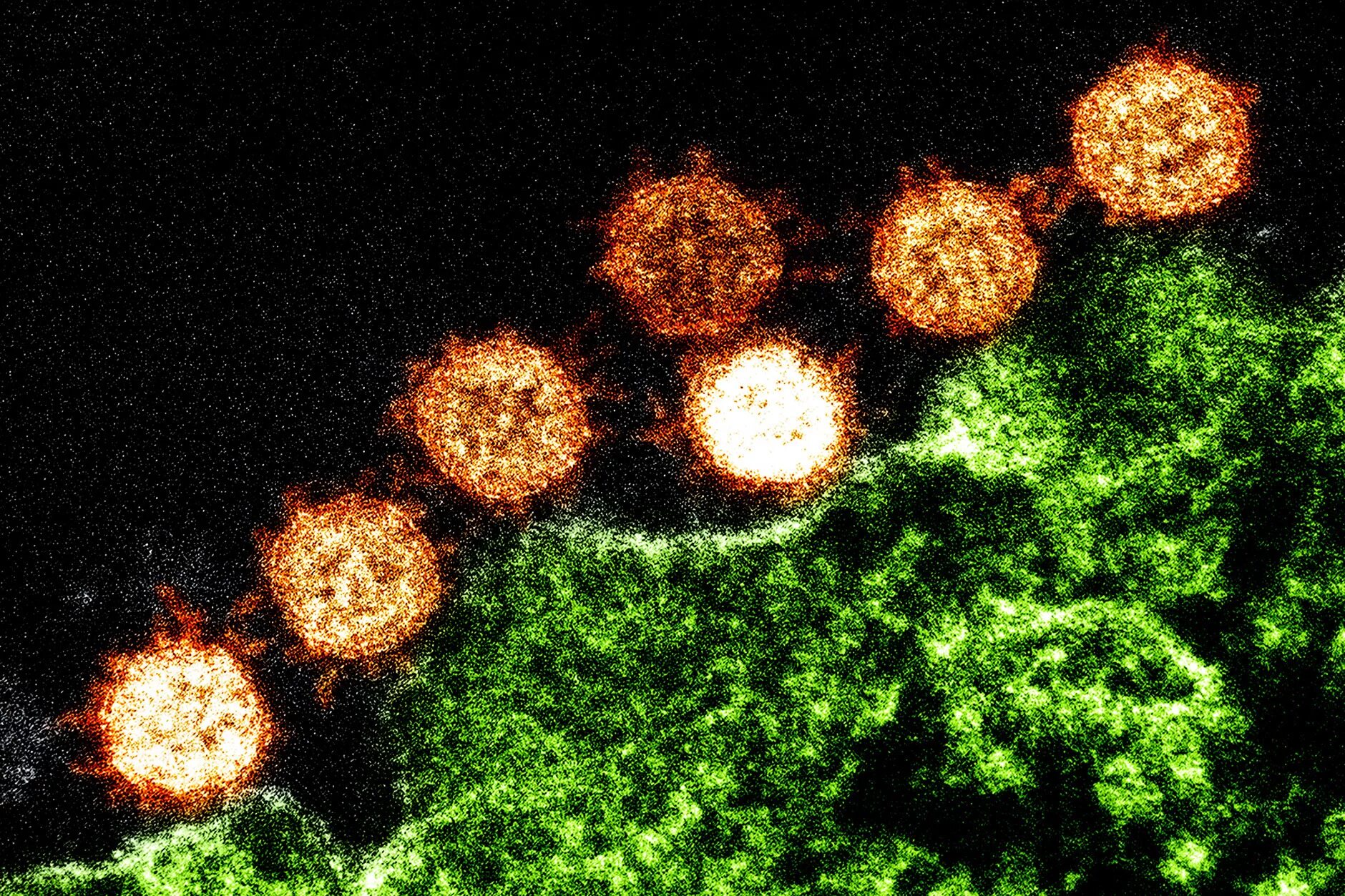 Коронавирусы какие заболевания. Коронавирус в микроскопе. Вирус коронавирус. Вирус SARS-cov-2 под микроскопом. Вирус Covid 19 под микроскопом.