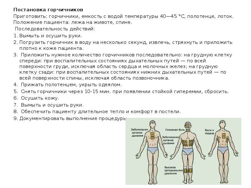 Сколько раз ставить горчичники. Постановка горчичников алгоритм. Методика постановки горчичников. Схема постановки горчичников. Памятка постановка горчичников.