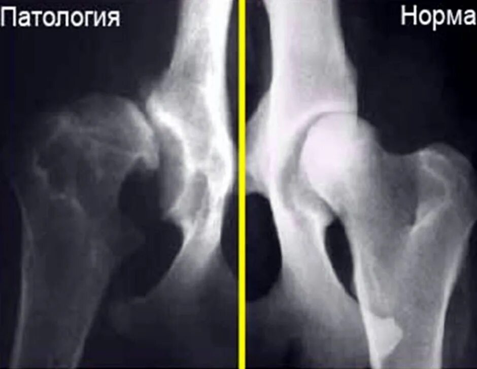 Дисплазия суставов у собак лечение. Дисплазия тазобедренного сустава у собак рентген. Подвывих тазобедренного сустава рентген.