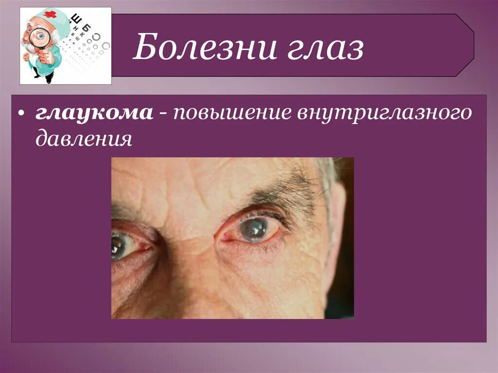 Заболевания глаз список. Болезни зрения у человека список. Наследственные заболевания зрения