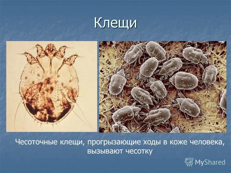 Почему чесоточного клеща часто называют зуднем ответ. Паукообразные клещи чесоточные. Чесоточный клещ Sarcoptes scabiei. Клещи чесоточный зудень.