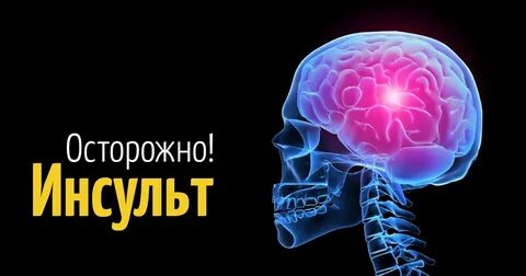 Инсульи