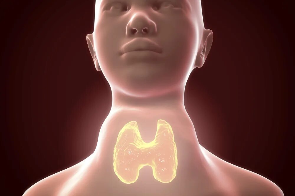 Заболевания, вызванные йодной недостаточностью. Щитовидная железа у детей. Увеличенная щитовидная железа. Эндемический диффузно-узловой эутиреоидный зоб. Увеличенная щитовидка у ребенка.