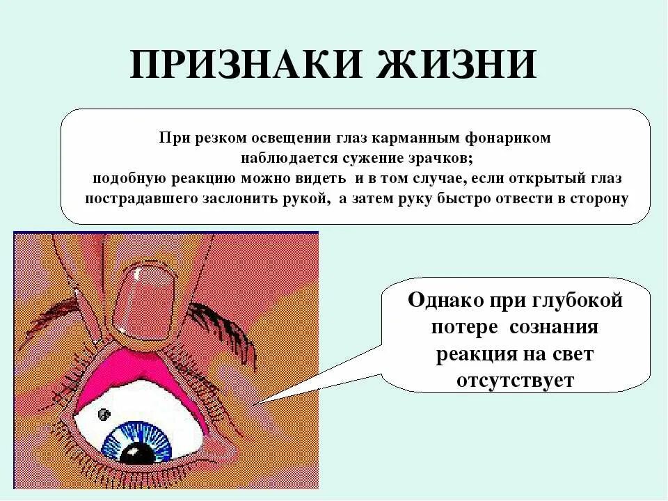 Признаки жизни. Реакция зрачков на свет при потере сознания. Признаки жизни у пострадавшего.