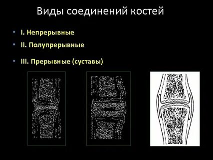 Полупрерывные соединения костей