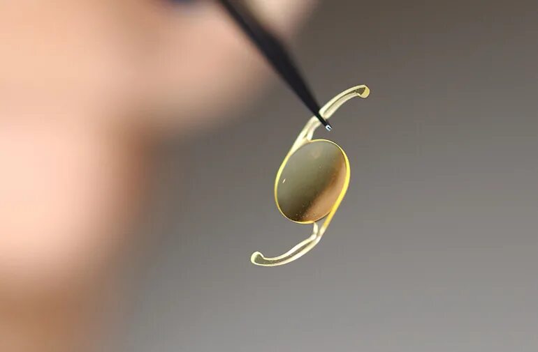 Хрусталик "carl zeiss 409 mv". Иол торическая линза. Монофокальные интраокулярные линзы. Лучший искусственный хрусталик. Лучший искусственный хрусталик.