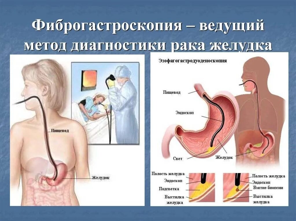 Как проверить язву