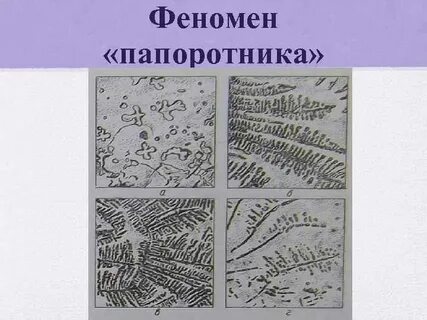 Феномен б