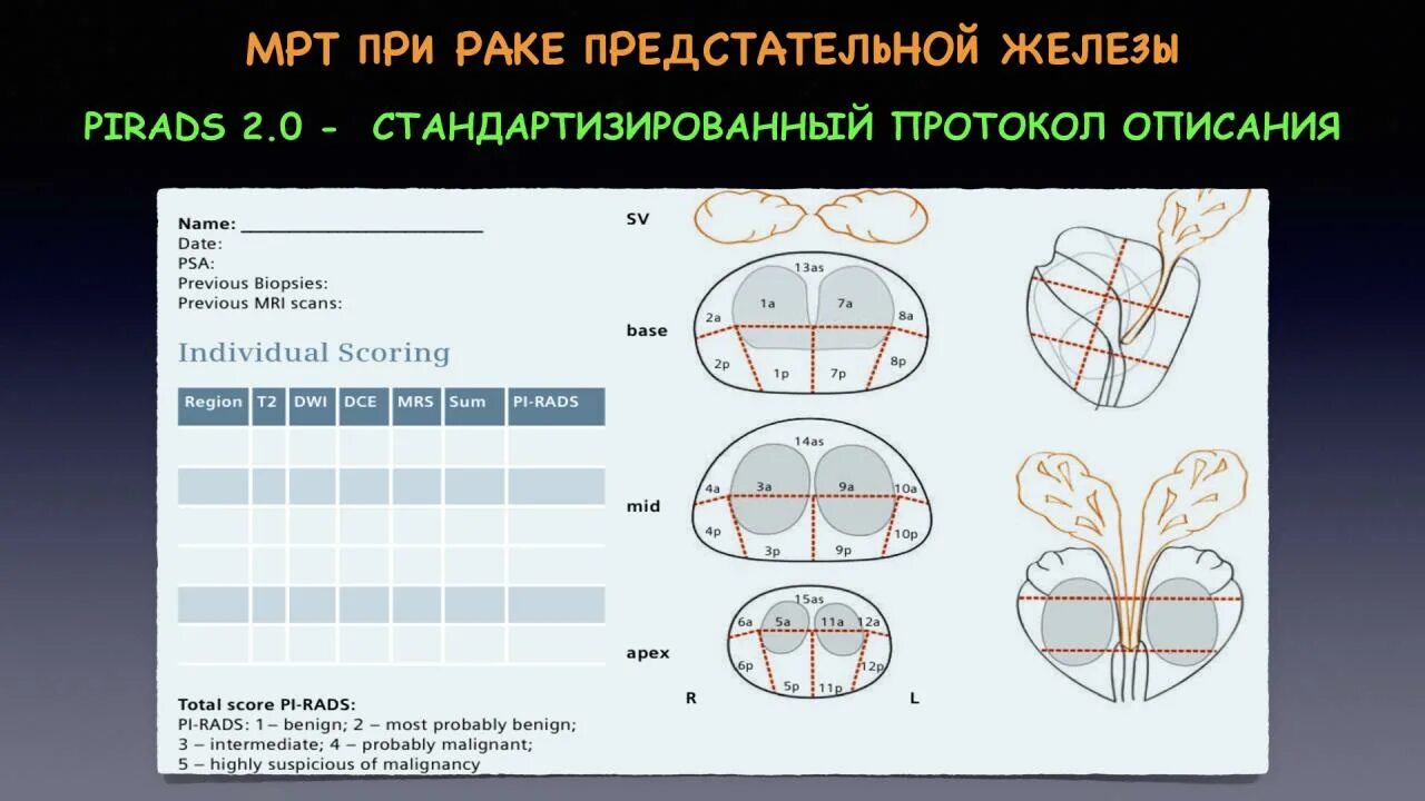 Схема простаты. Схема предстательной железы Pirads. Сегменты простаты по Pirads. Зоны предстательной железы Pirads.