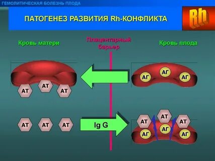 Резус болезнь