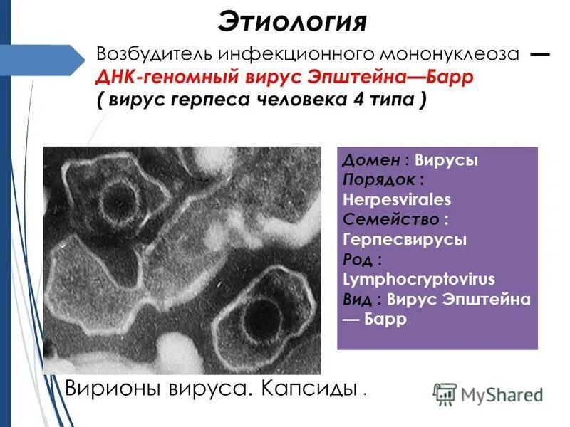 Мононуклеоз вирус эпштейна