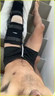 Noah Centineo Shows How He Showers After Undergoing Knee Replacement Surger...