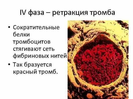 Красный тромбоз