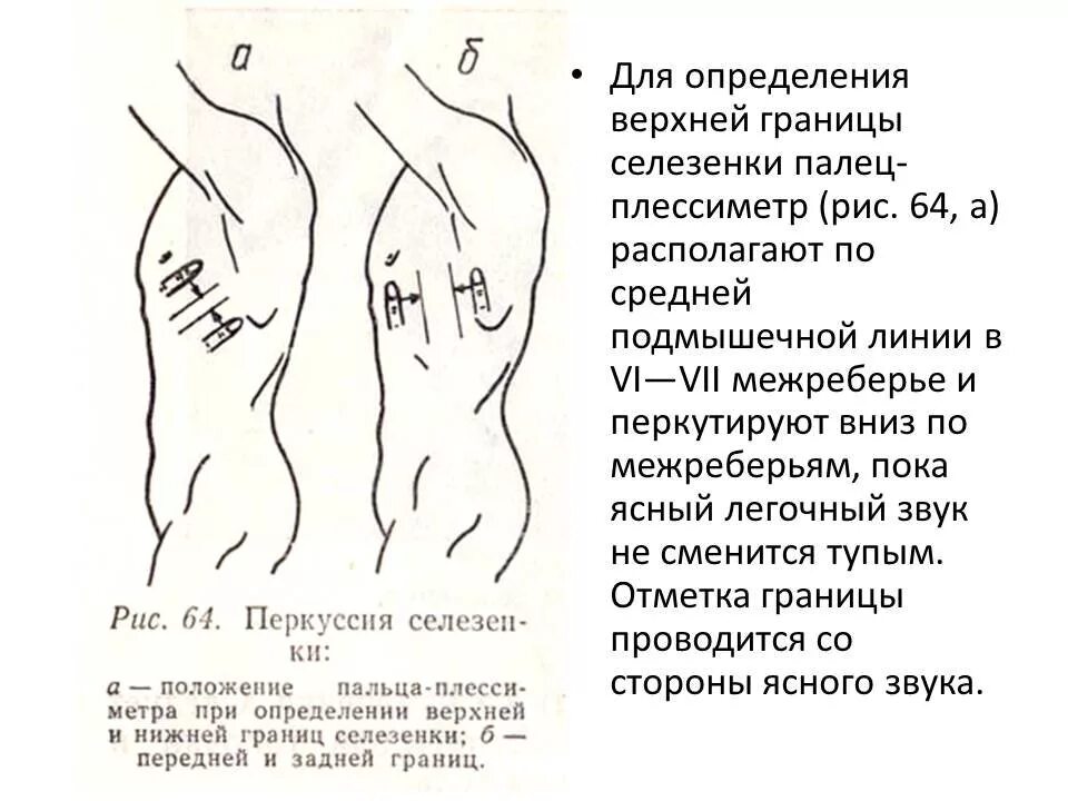 Перкуссия селезенки по курлову. Перкуссия селезенки схема. Методика определения размеров селезенки. Перкуссия селезенки в норме. Длинник и поперечник