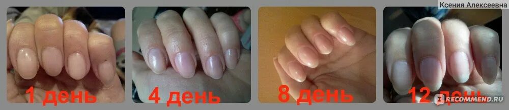 Через сколько вырастет ноготь. Через сколько вырастет ноготь