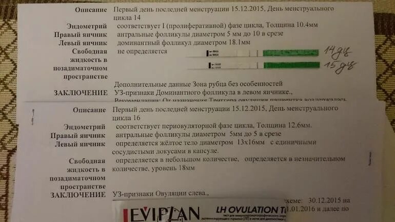 Желтое тело по дням цикла. Размер желтого тела после овуляции. Желтое тело на 20 день цикла. Желтое тело на 12 день цикла. Фолликул яичника размеры