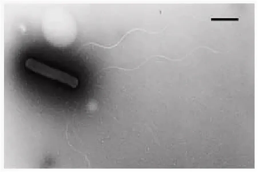 Megasphaera spp