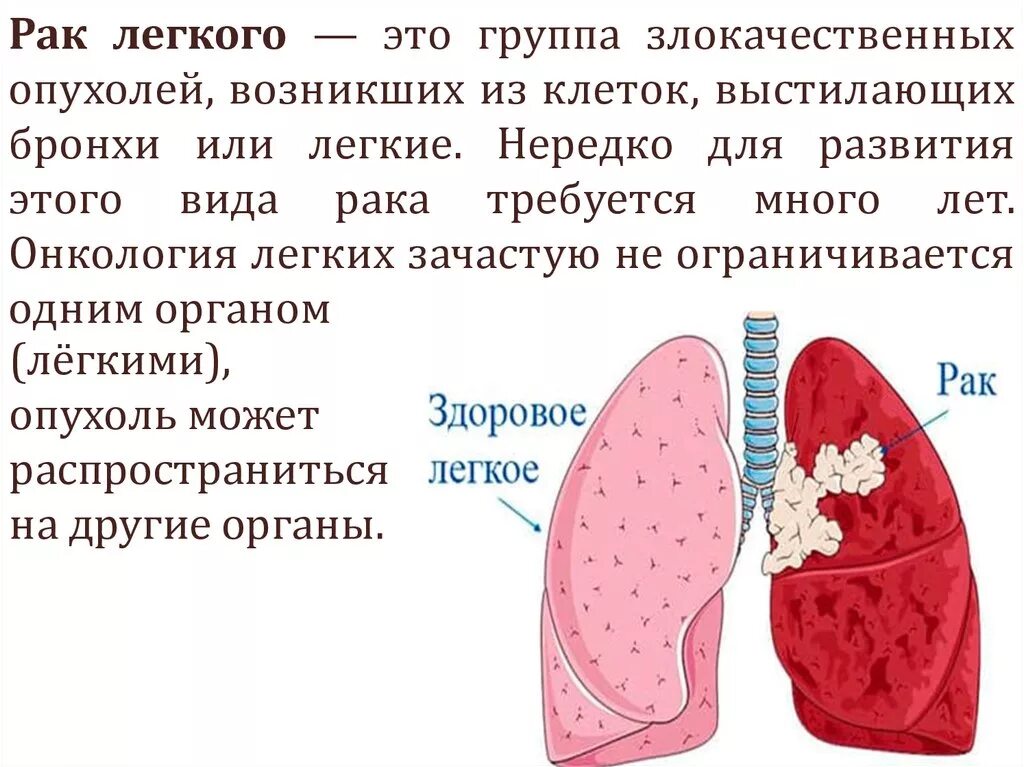 Много информации о легких. Легкие. Злокачественная опухоль легких.