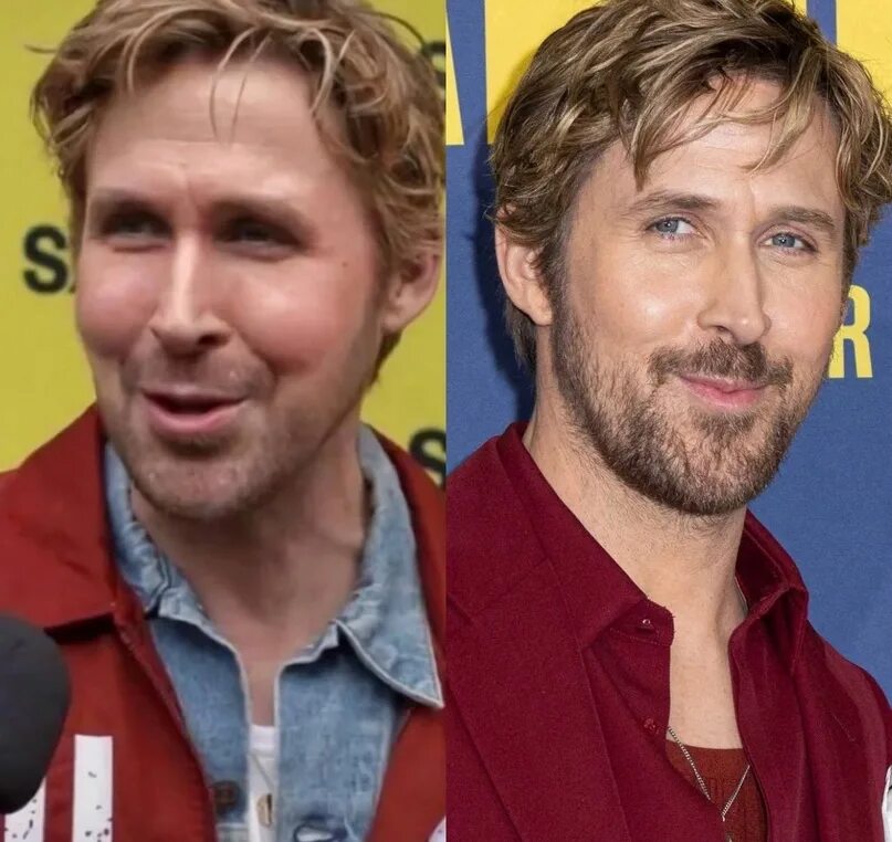 Гослинг до и после пластики ryan gosling pictures in 2019 Nose surgery, Surgery, Celebrity plastic surgery