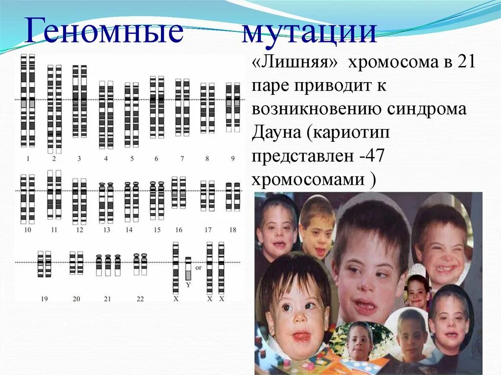 Синдром дауна лишняя хромосома. Геномные мутации. Геномные мутации кариотип. Синдром Дауна геномная мутация. Синдром Дауна хромосомная мутация.