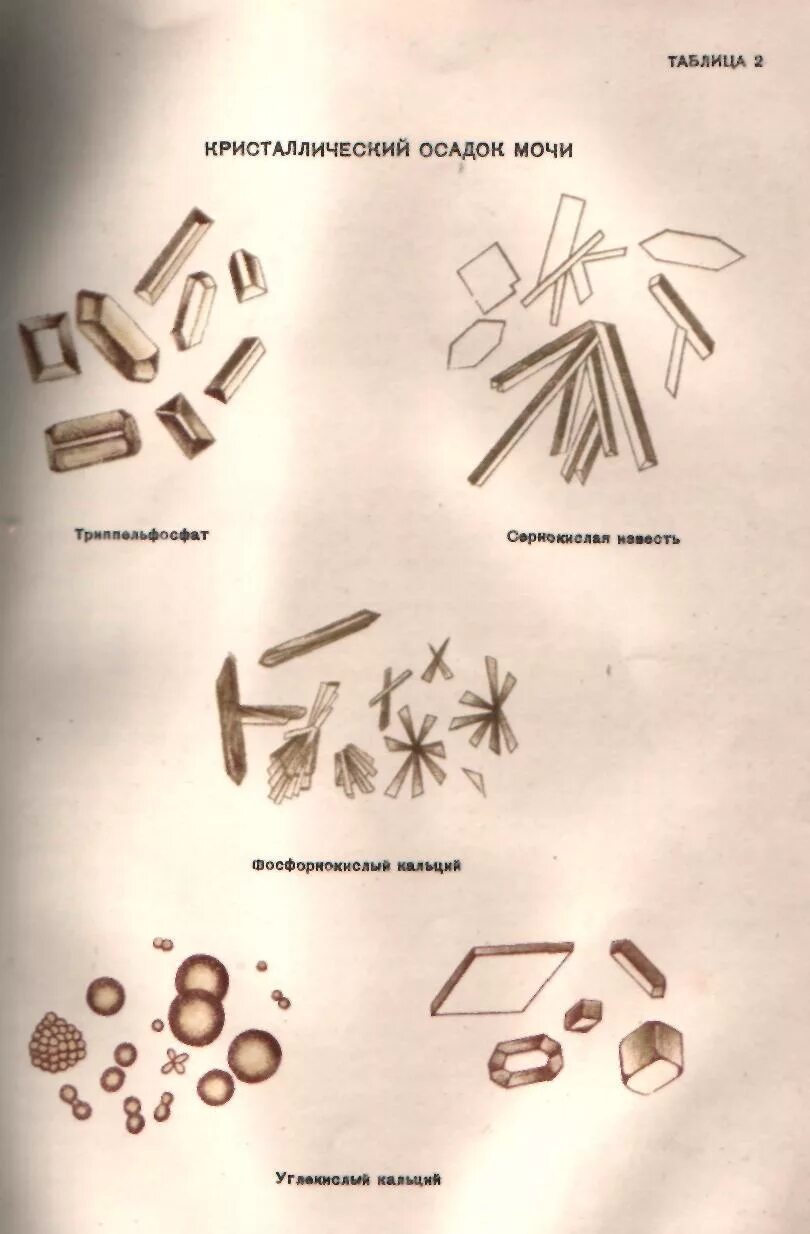 Кристаллы кальция в моче у мужчин. Тирозин в моче микроскопия. Кристаллы мочевой кислоты в моче микроскопия. Микроскопия осадка мочи соли. Микроскопия мочи Кристаллы.
