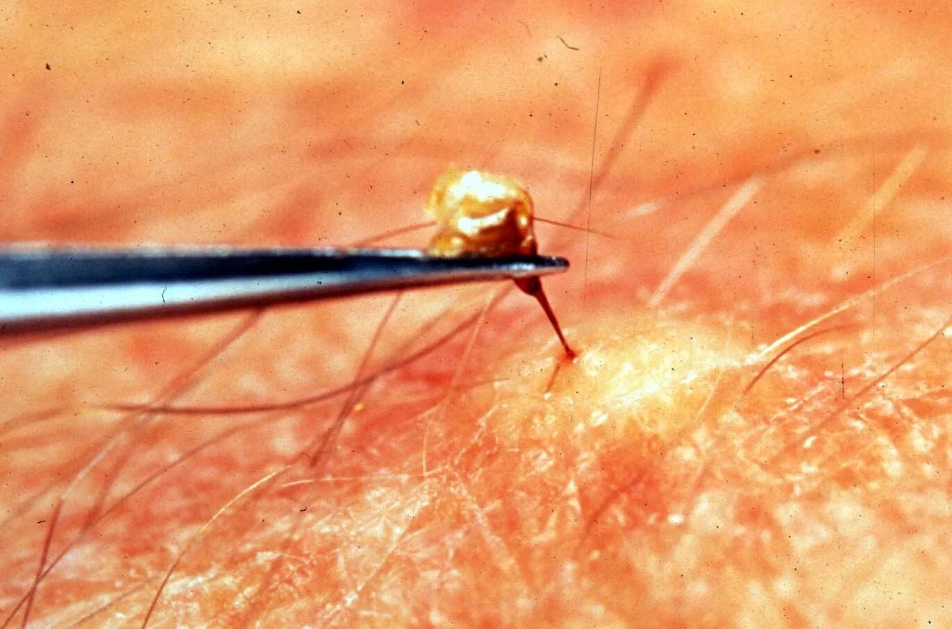 пчелы оставляют жало