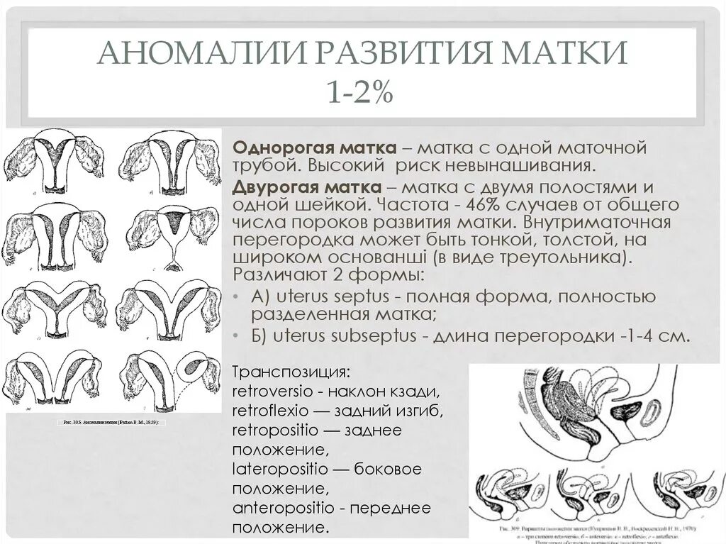 Недоразвитая матка у мужчин. Врожденные пороки развития матки. Аномалии развития матки классификация. Аномальное развитие матки. Аномалия развития матки седловидная.