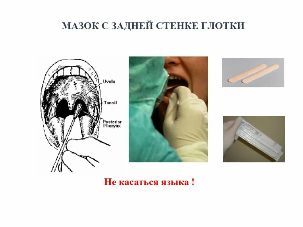 Посев полости рта. Забор материала из носоглотки. Взятие мазка из носоглотки. Забор материала на дифтерию.