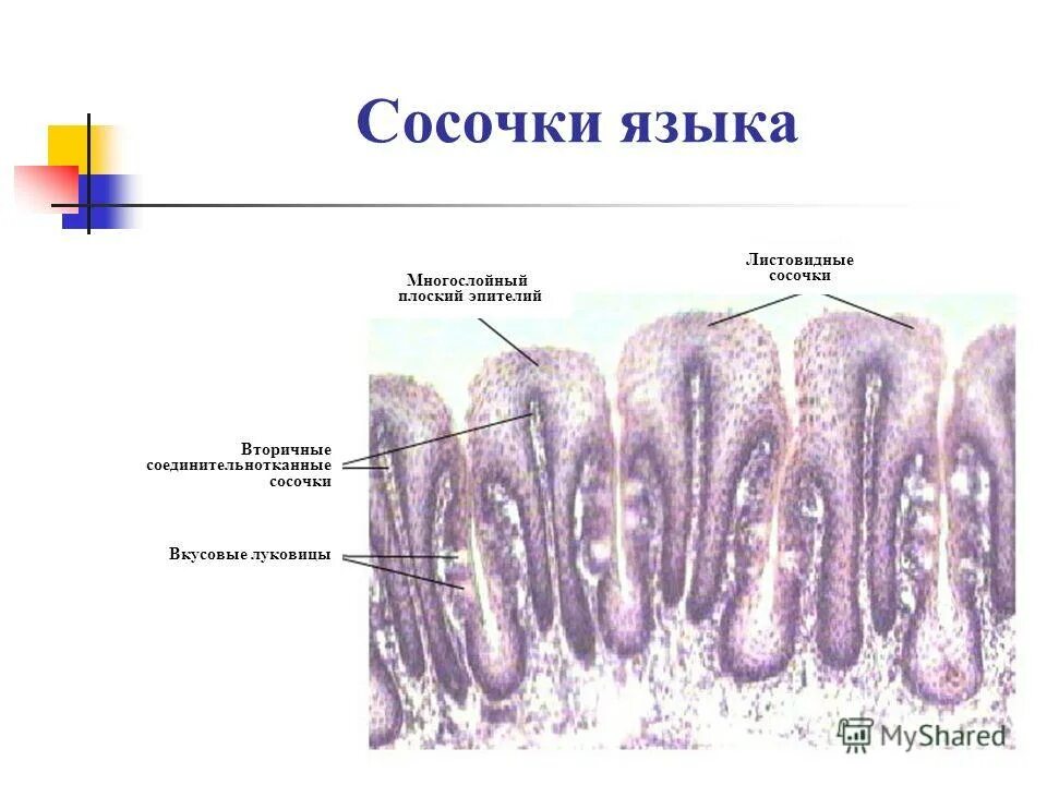 листовиднвй сосочек язык гистология. листовидный сосочек гистология. нитевидные сосочки гистология препарат. листовидные сосочки. грибовидные сосочки эпителий.