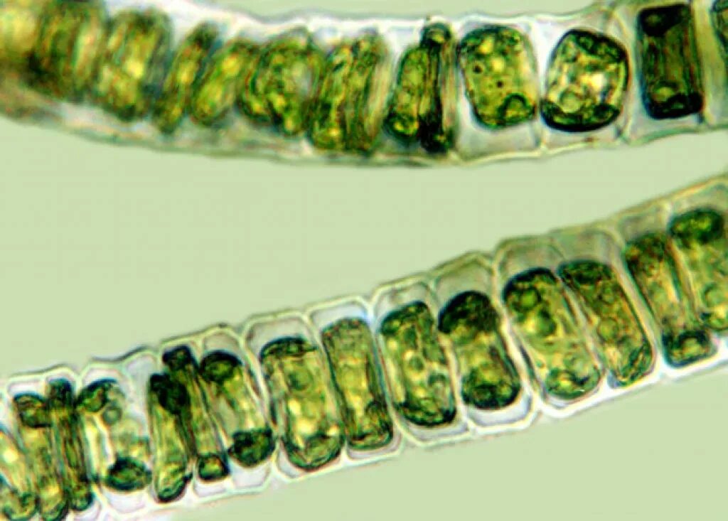 Ulothrix zonata. Улотрикс. Улотрикс таллом. Многоклеточные зеленые водоросли улотрикс.