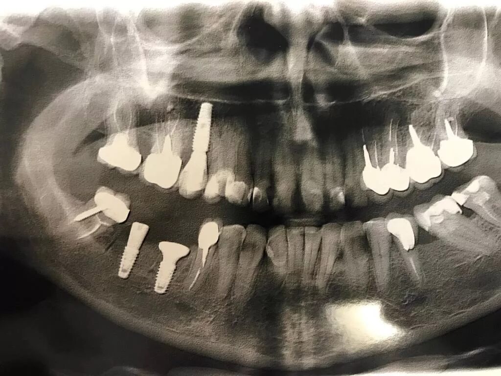 31 Teeth ideas teeth, dental, dental health