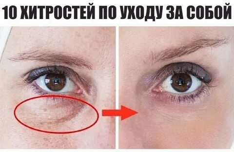 Осветлить под глазами