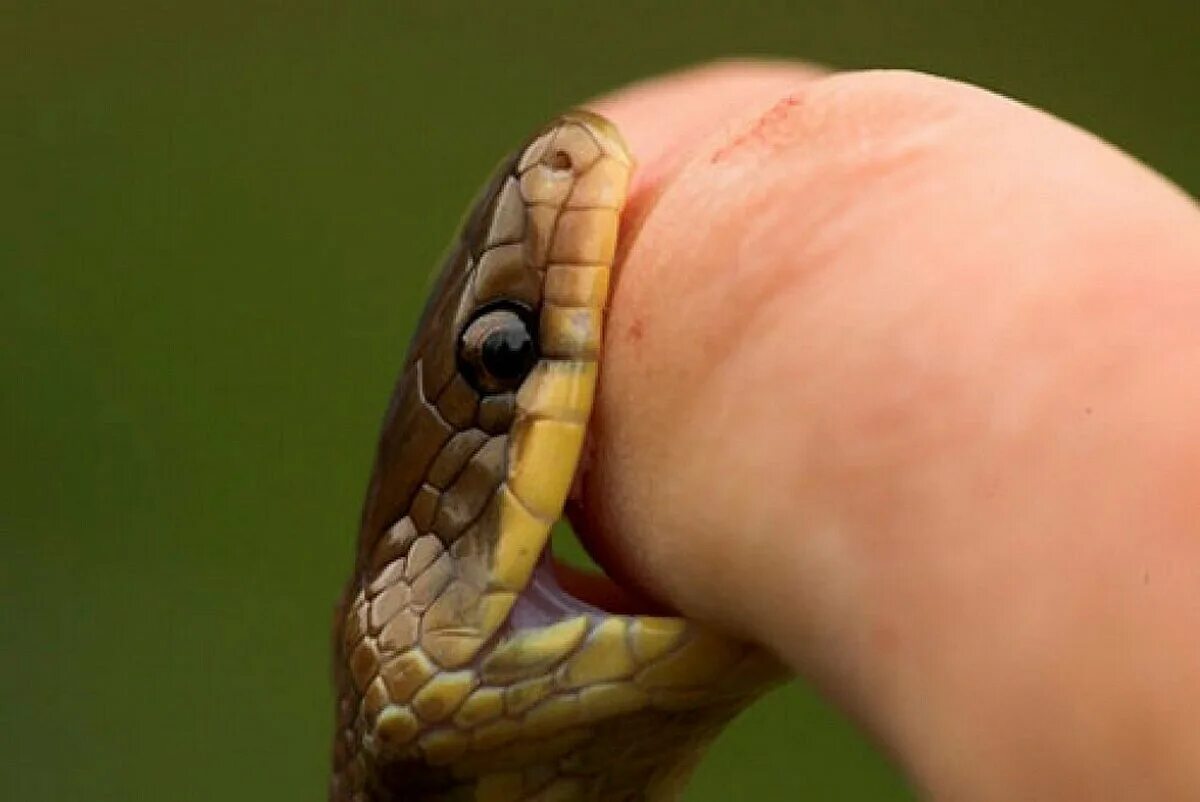 Snake bites. Snake bites