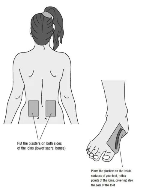 Перцовый пластырь на поясницу. Перцовый пластырь на седалищный нерв. Куда наклеить пластырь. Схемы пластыря на спине. Куда приклеивать пластырь на пояснице.