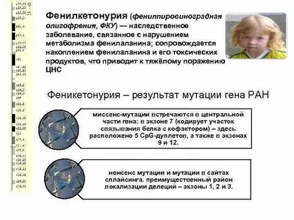 Фенилкетонурия мутация