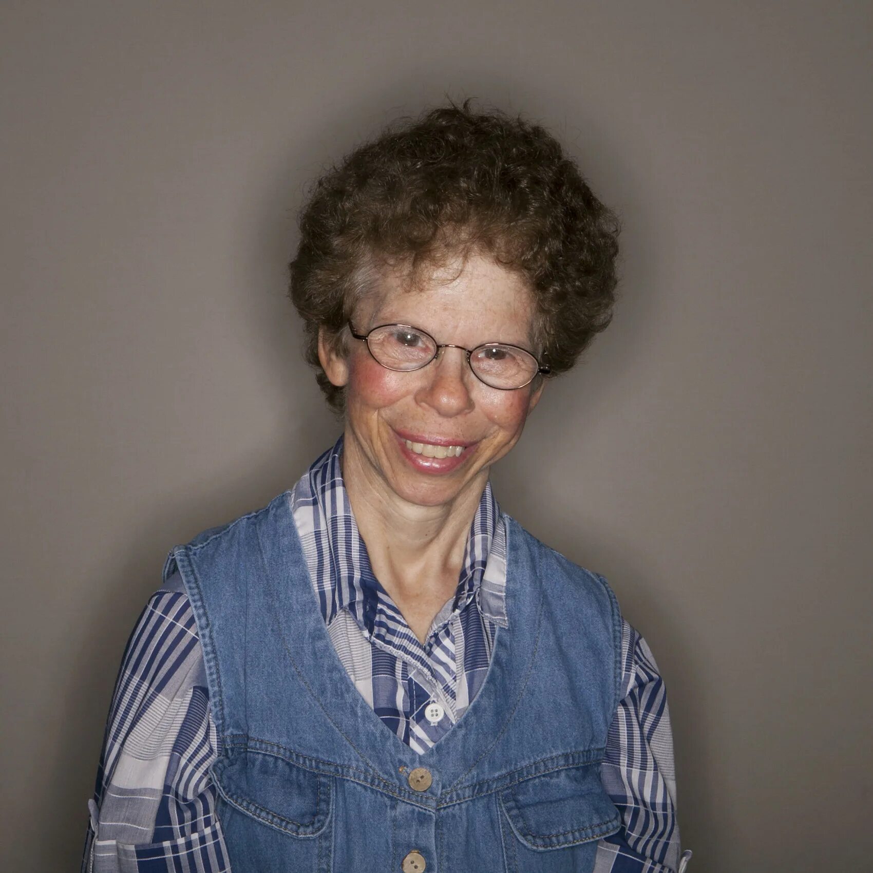 Синдром вильямса лицо эльфа фото. Дети эльфы синдром вильямса. Дети эльфы синдром вильямса. Синдром вильямса бойрена. Лицо эльфа.