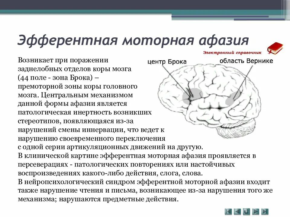 Афазия Брока локализация. Локализации поражения головного мозга при афазии. Моторная афазия Брока. Моторная Эфферентная афазия Брока локализация. Поражения корково мозга