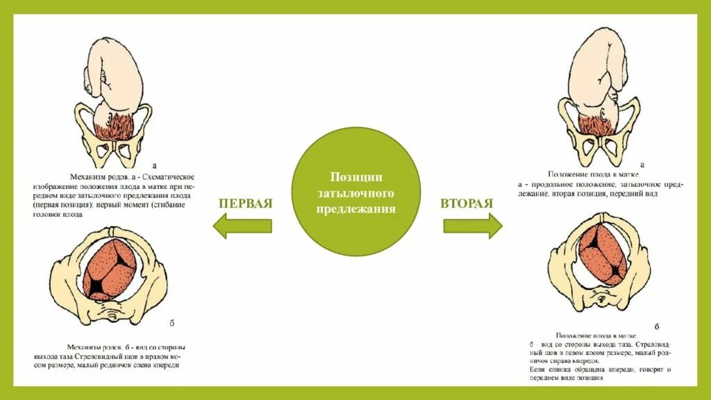 Самопроизвольные роды в затылочном предлежании. Роды в переднем виде затылочного предлежания. Задний вид затылочного предлежания биомеханизм. Передний вид затылочного предлежания биомеханизм родов. Передний и задний вид затылочного предлежания.