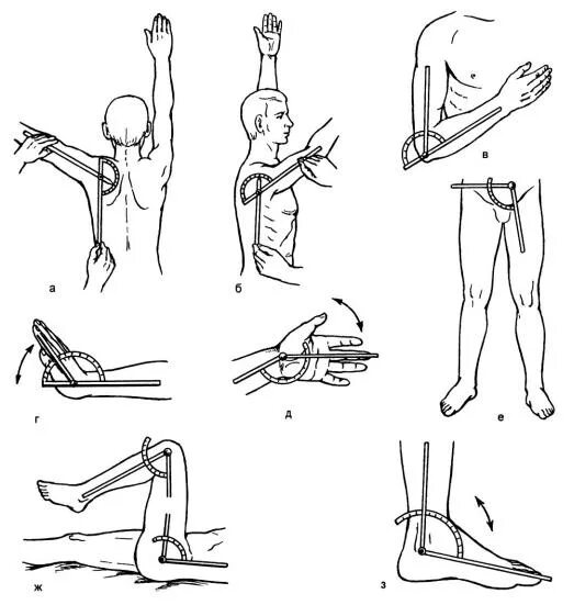 Ограничение движения в коленном суставе. Флексия тазобедренного сустава. Гониометрия тазобедренного сустава. Контрактура тазобедренного сустава. Измерение отведения тазобедренного сустава.