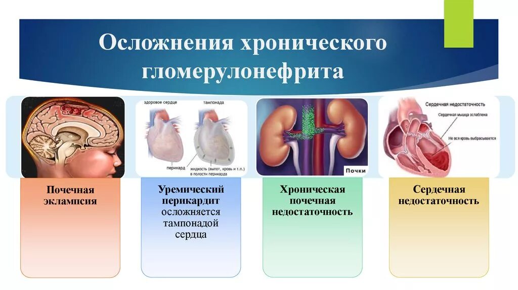 Хронический пиелонефрит роды. Гломерулонефрит клиника симптомы. Осложнения при остром гломерулонефрите. Осложнения хронического гломерулонефрита. Вторичная профилактика хронического гломерулонефрита.