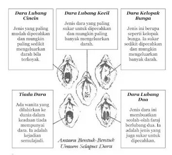 Software perawan