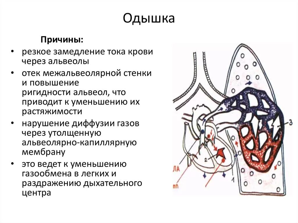 Как отличить легочную одышку от сердечной