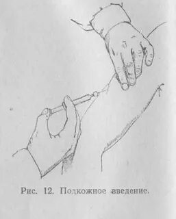 Подкожное введение в плечо