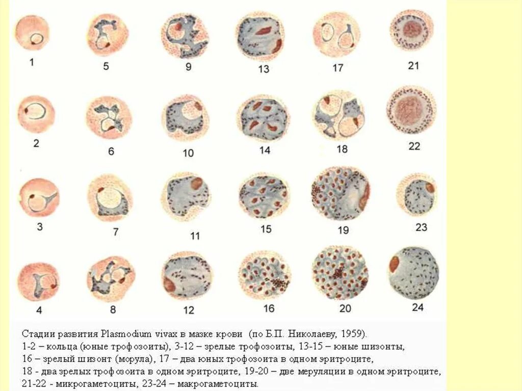 Plasmodium Vivax на стадии кольца. Плазмодий Вивакс стадии развития амебовидный шизонт. Амебовидный шизонт малярийного плазмодия. Стадии развития плазмодия Вивакс. Микрогаметоцит это