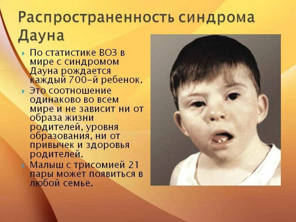 Синдром Дауна. Олигофренопедагогика.