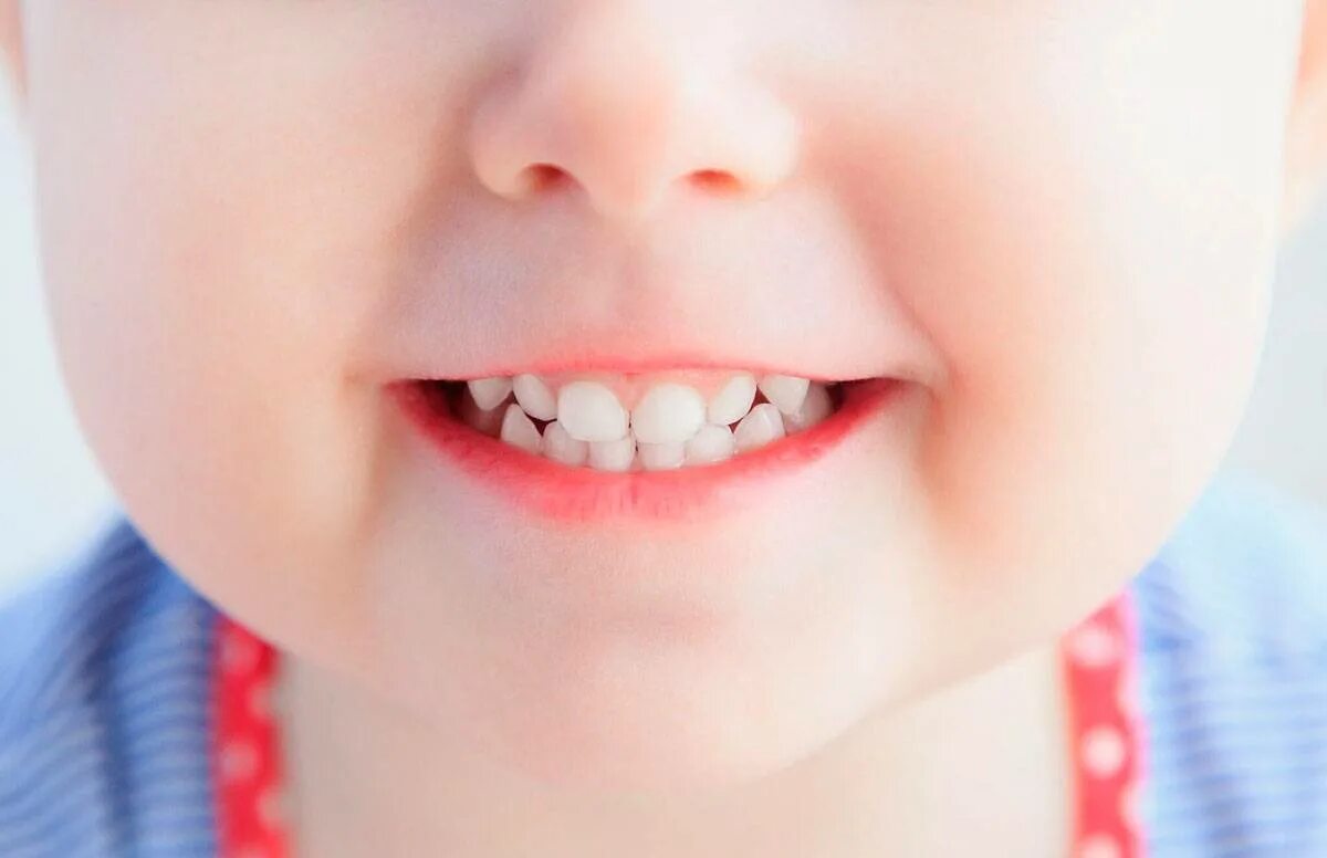 Ребенку 2 года 12 зубов
